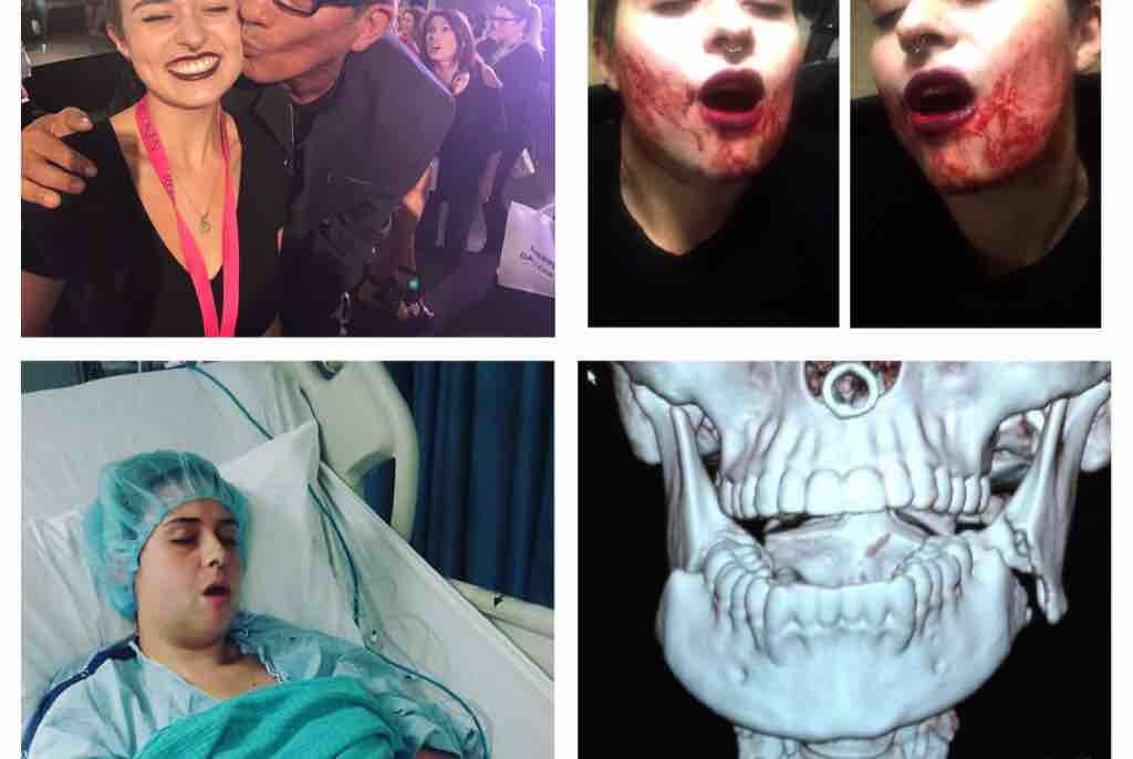 Woman Suffers Catastrophic Injury at Code Orange Concert