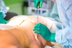 plastic-surgery-risks-complications