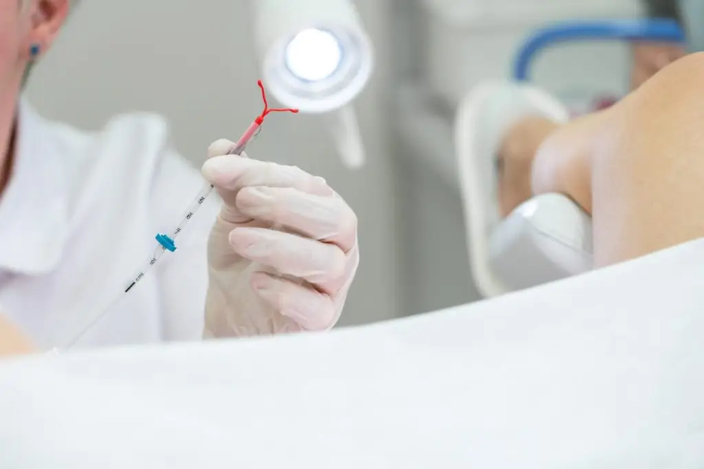 Lawsuits Claim Bayer Covered Up Essure Injury Claims