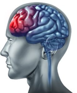 Head Injury lawyer