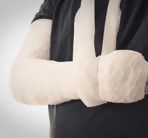 broken bones from an e-scooter injury