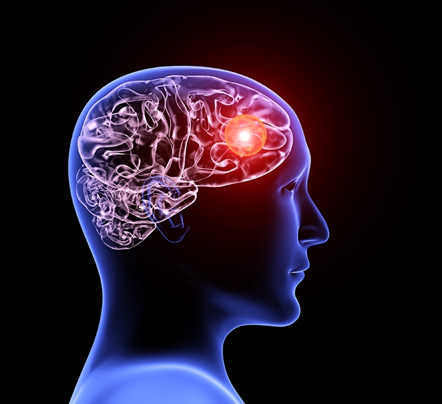types of brain injuries that can be suffered in Buena Park
