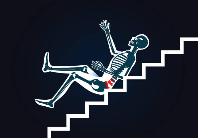 Why are slip and fall accidents so prevalent? There can be several reasons for this phenomenon. First, people, especially the elderly, are more mobile than in previous generations. With older people out golfing, fishing, walking, and biking, there are going to be more injuries per capita than in earlier years when older people often stayed at home and “rocked on the porch.” Further, stores and other venues are far more crowded these days than in the past. It is very easy for someone to knock into or otherwise accidentally push a senior citizen and cause an accident. Finally, employees and employers both seem to suffer from a certain degree of apathy regarding keeping store or job site conditions safe—at least until someone falls and is injured. At that point, the defending party may decide to fight the payment of just damages by citing all sorts of reasons that the accident is not its responsibility. This is one reason why you need the services of professionals such as Irvine slip and fall lawyers if you have been involved in one of these accidents.