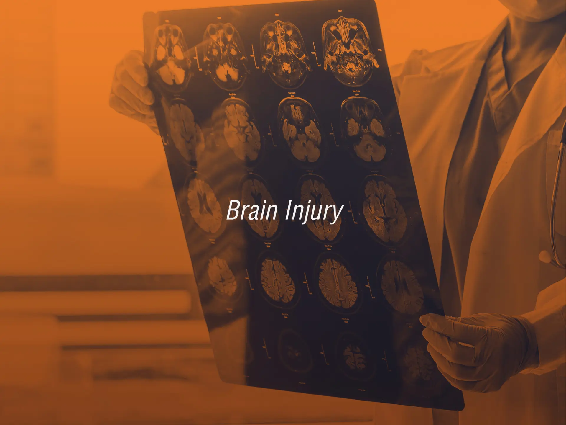 Los Angeles Brain Injury lawyer