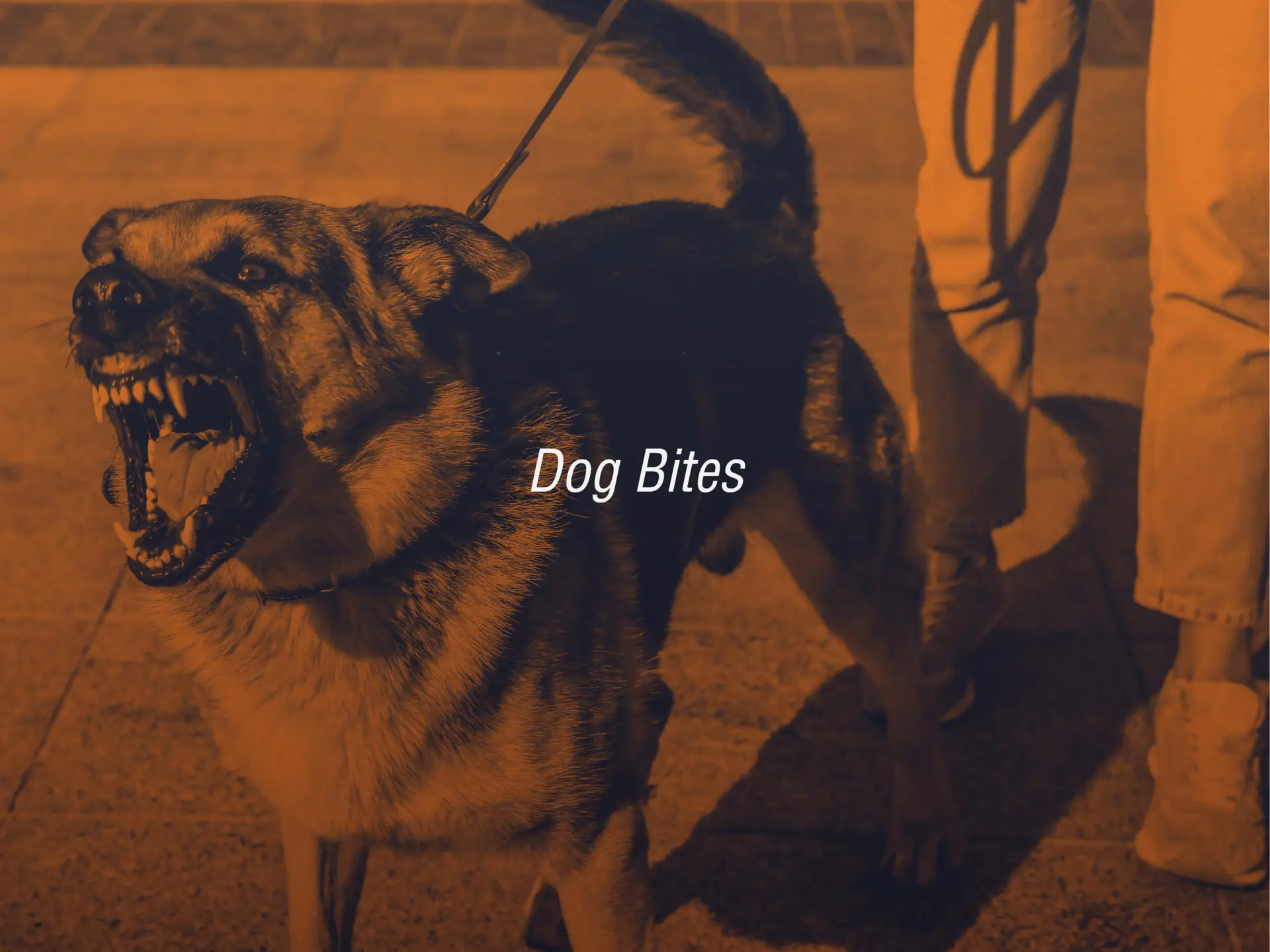 Orange County dog bite lawyers