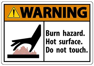 Common causes of burn injuries