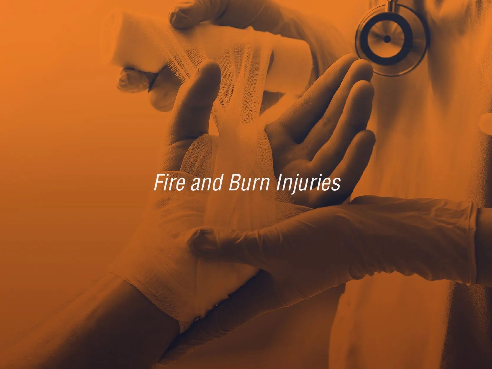California burn injury lawyers